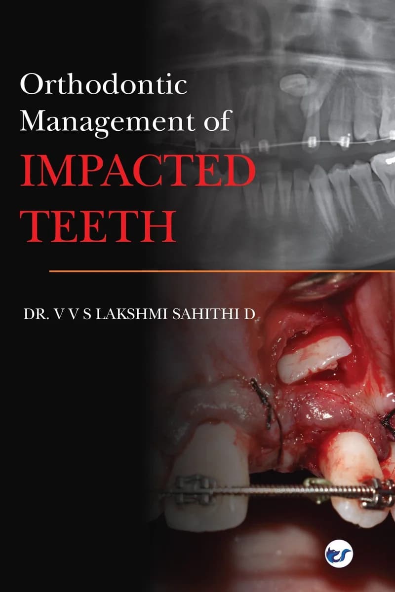Orthodontic Management Of Impacted Teeth