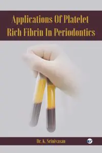 Applications Of Platelet Rich Fibrin In Periodontics