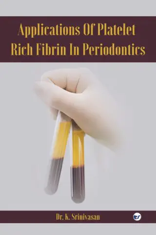 Applications Of Platelet Rich Fibrin In Periodontics