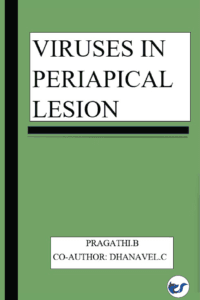 Viruses In Periapical Lesion
