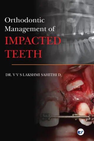 Orthodontic Management Of Impacted Teeth