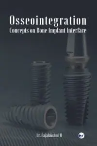 Osseointegration ? Concepts On Bone Implant Interface