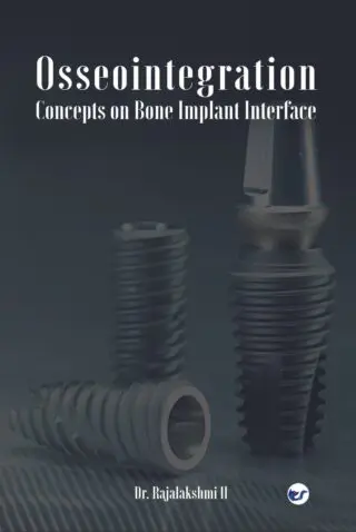 Osseointegration ? Concepts On Bone Implant Interface