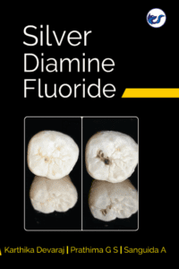 Silver Diamine Fluoride