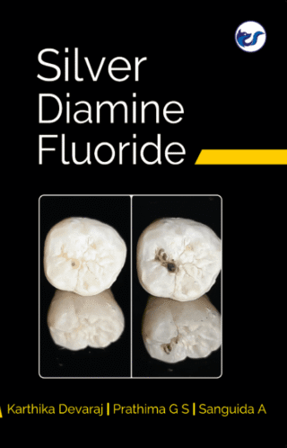 Silver Diamine Fluoride