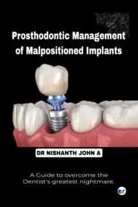 Prosthodontic management of malpositioned implants