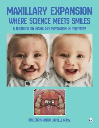 Maxillary Expansion Where Science Meets Smiles: A Textbook on Maxillary Expansion in Dentistry