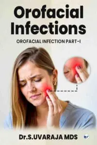 Orofacial Infections