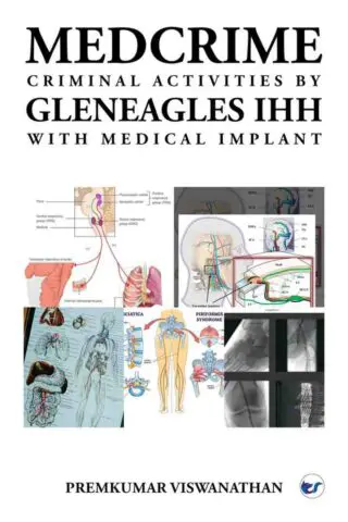 MEDCRIME criminal activities by GLENEAGLES IHH WITH medical implant