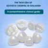 BEYOND STAINLESS STEEL: THE NEW ERA OF ESTHETIC CROWNS IN CHILDREN