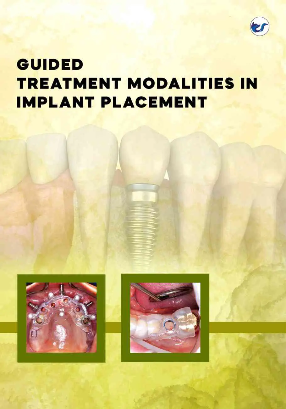GUIDEDTREATMENTMODALITIES GUIDED TREATMENT MODALITIES IN IMPLANT PLACEMENT