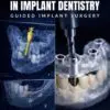 surgical guides in implant dentistry: guided implant surgery