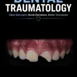 handbook on dental traumatology: clear concepts. quick decisions. better outcomes.